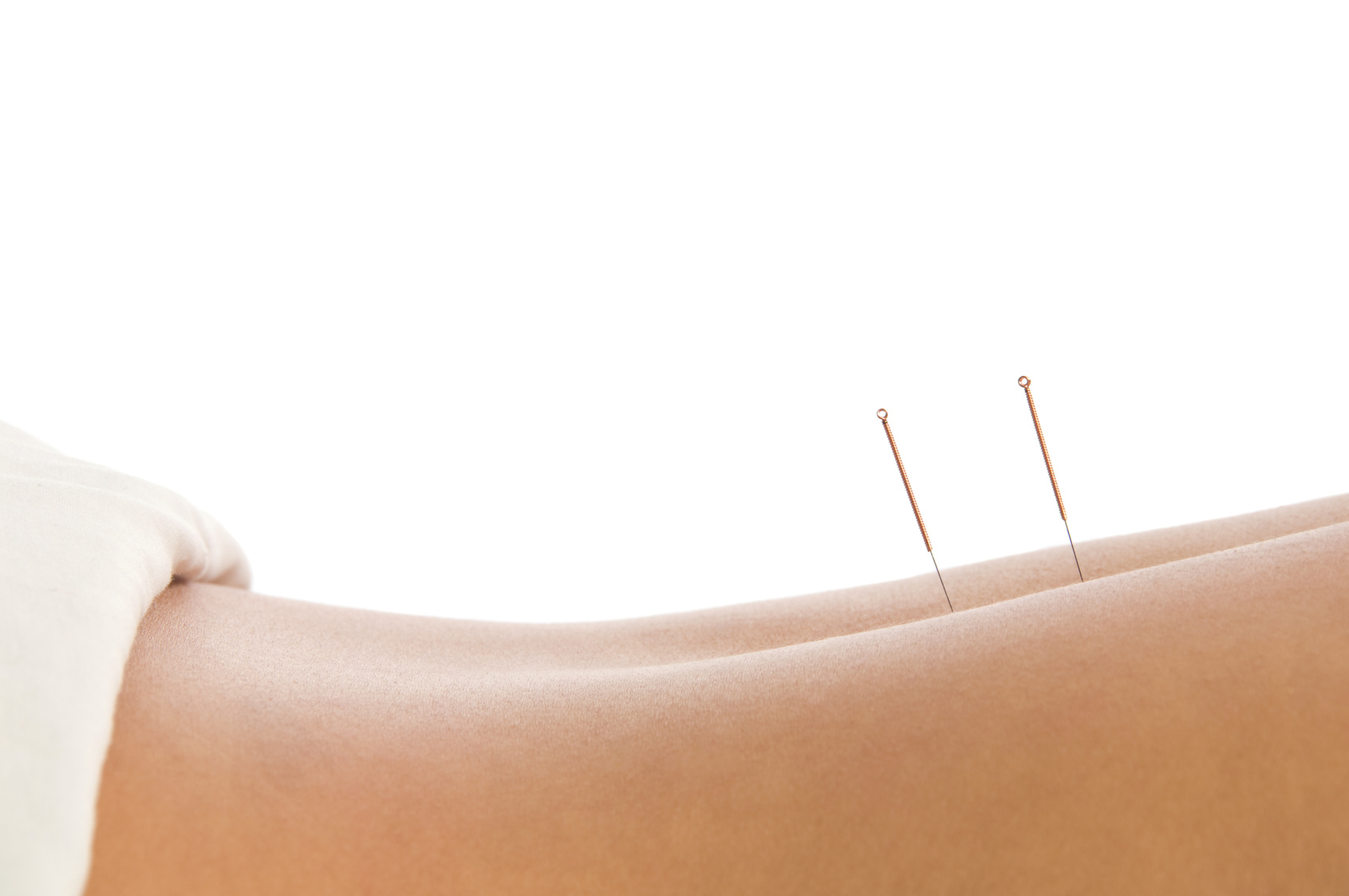 New Year, New Me! How Can Acupuncture Help?