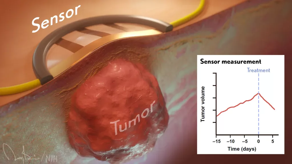 Wearable Sensor Promises More Efficient Early Cancer Drug Development